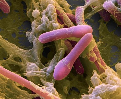 bakterijos Clostridium botulinum schema
