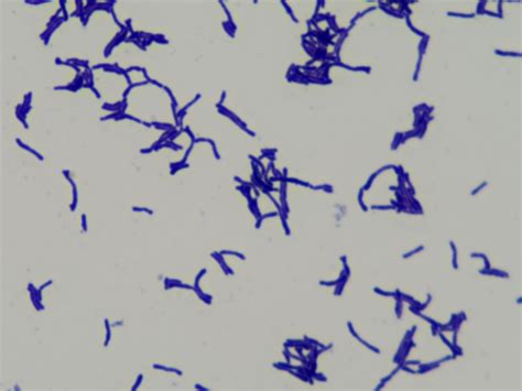 Žemėlapis, rodantis B. longum infantis ir B. longum longum paplitimą