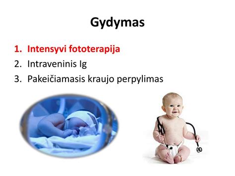 Naujagimių geltos gydymas fototerapija