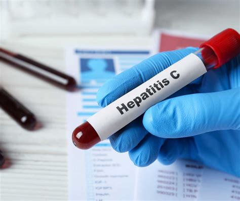 Hepatito C perdavimo būdai