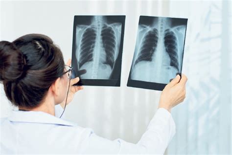 Nuotrauka: Gydytojas klauso paciento plaučius stetoskopu