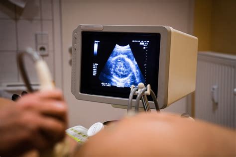Ultragarso tyrimas nėštumo metu