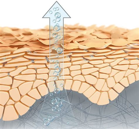 Schematinis pavaizdavimas, kaip sausa oda tampa pažeidžiama