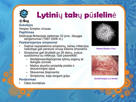 Infekcijos simptomų pasiskirstymas lytinių takų anatomijoje