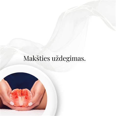 Scheminis makšties anatomijos pavaizdavimas