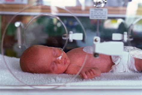 Lietuvos naujagimių reanimacijos skyriaus nuotrauka