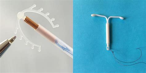 Hormoninės spiralės veikimo principo schema
