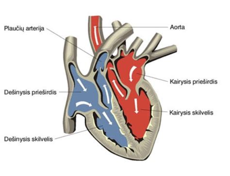 anatominė širdies schema su skilvelių ir prieširdžių pertvarų defektais