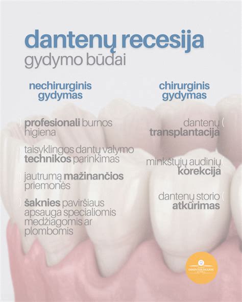Taisyklinga dantų valymo technika