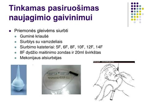 Gaivinimo stalelis