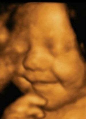 3D ir 4D vaisiaus echoskopijos vaizdai