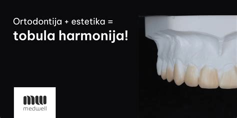 Šypsena po sėkmingo ortodontinio gydymo