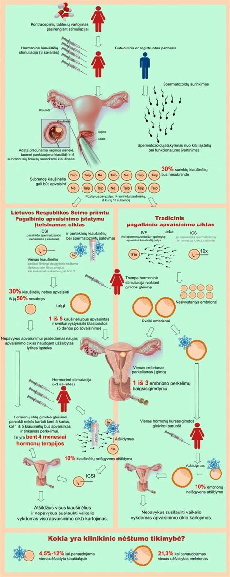 infografikas apie pagalbinio apvaisinimo teisinį reglamentavimą