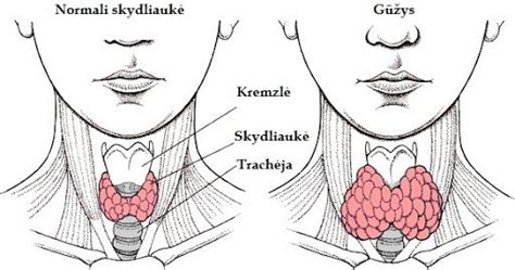 Skydliaukės anatomija