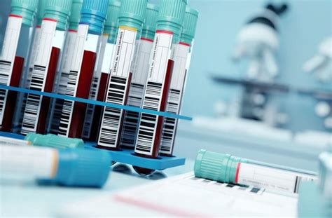 Nėščiosios kraujo tyrimai ir hemostazės sistema