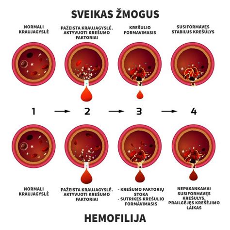 Kraujo krešėjimo faktoriai ir jų poveikis