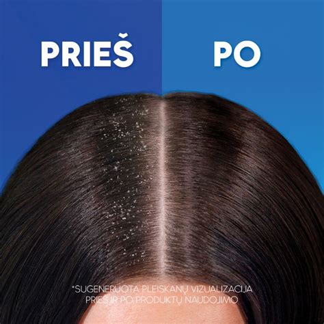 Galvos odos struktūra ir pleiskanų atsiradimo mechanizmas