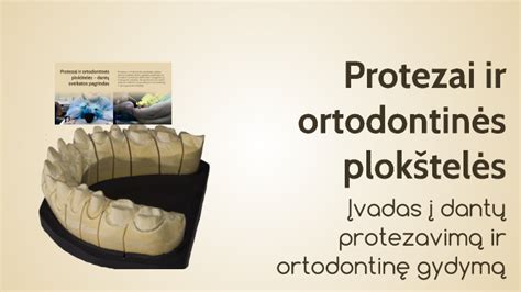 Ortodontinės plokštelės struktūra ir sudedamosios dalys