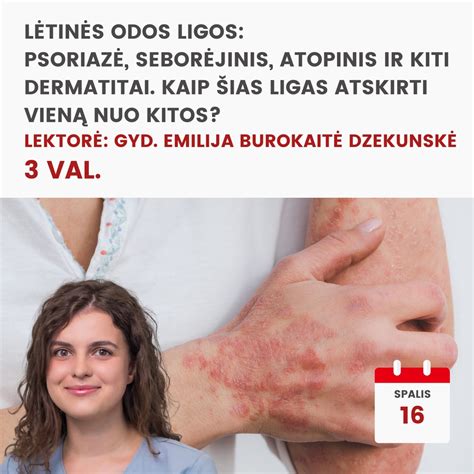 infografika: kaip atskirti tikrus sąrėmius nuo treniruočių sąrėmių