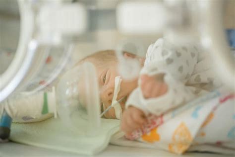Priešlaikinio kūdikio nuotrauka inkubatoriuje