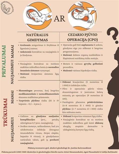 Infografika apie gimdymo pozas