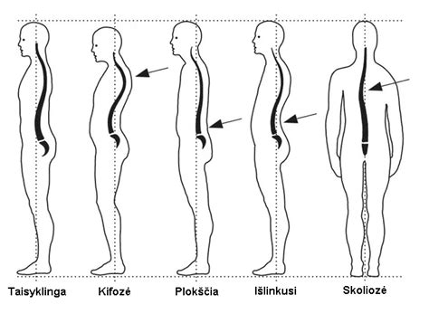 Taisyklinga stovėjimo laikysena nėštumo metu