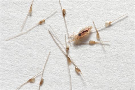 Utėlių glindos ant plauko