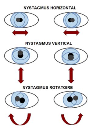 Nistagmo tipai ir akių judesiai