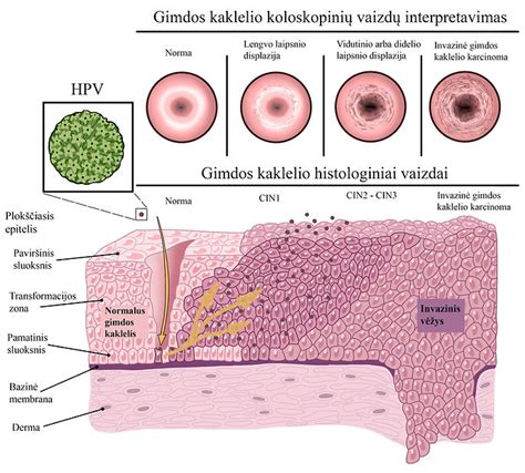 Gimdos gleivinės sandaros schema