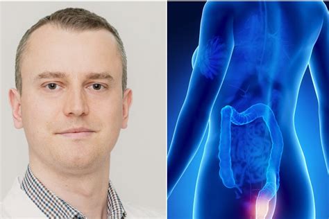 Gydytojas konsultuojantis pacientą apie hemorojaus gydymą