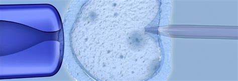 Apvaisinimo mėgintuvėlyje (IVF) procesų seka