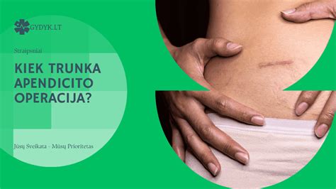 apendicito lokalizacija pilvo srityje