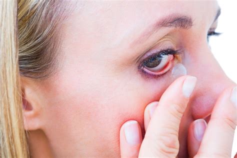 Nėščiosios akies priežiūra