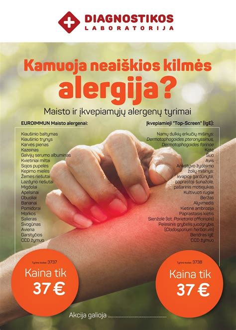alergijos tyrimų eiga klinikoje