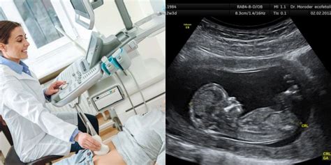 Nėščiosios apžiūra ir ultragarsas