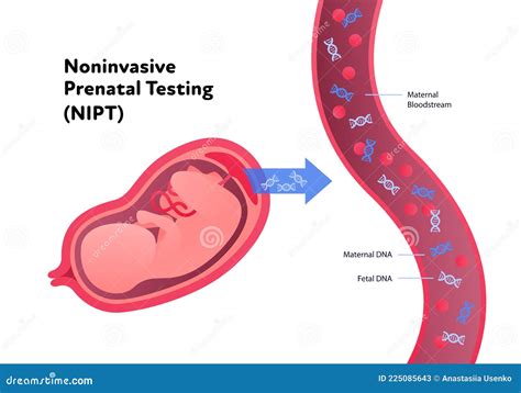 NIPT tyrimo schema