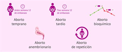 Chirurginio aborto schema