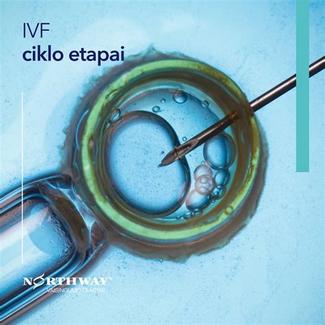 IVF (apvaisinimo mėgintuvėlyje) proceso eiga
