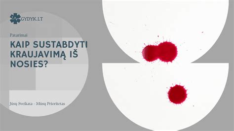 Kaip sustabdyti kraujavimą iš nosies