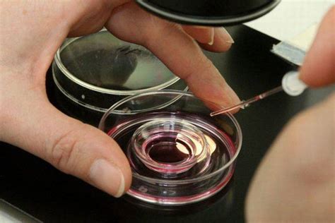 Dirbtinio apvaisinimo (inseminacijos) metodai
