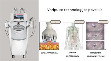 Intrauterinio apvaisinimo procedūra