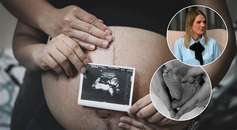 Akušerė aiškina apie gimdymo procesą porai
