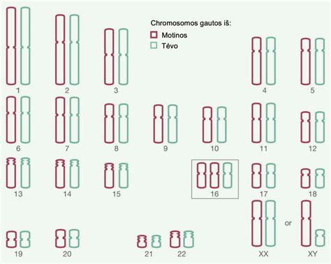 Chromosomų anomalijos - trisomijos schema
