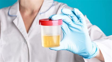 kūdikio besilaukianti moteris ir laboratorinis šlapimo tyrimas