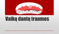 vaikų dantų traumos