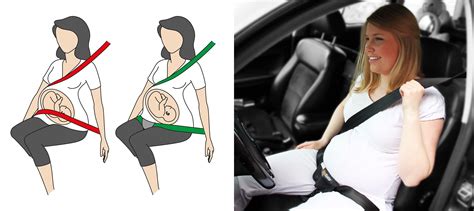 Nėščiosios saugos diržas automobilyje
