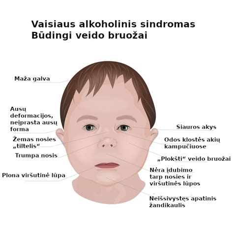Schema: Alkoholio kelias į vaisiaus organizmą per placentą