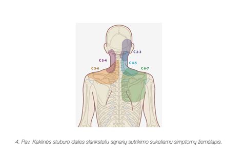 Naujagimio kaklo ir krūtinės srities prakaitinė