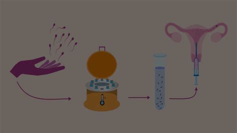 Spermatozoidų atrankos procesas IUI procedūrai