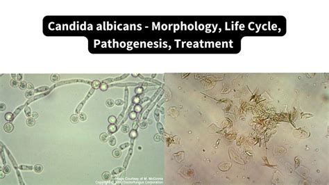 Schematinis grybelio Candida albicans atvaizdas